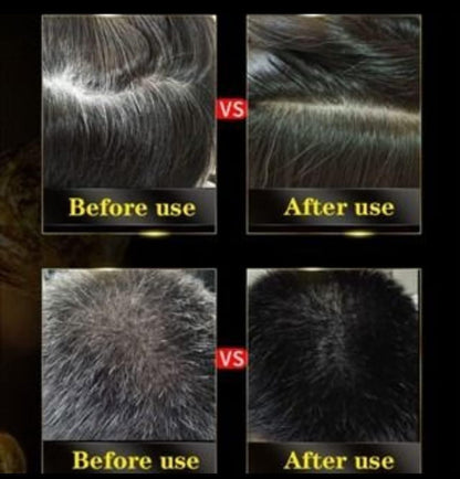 Grey Hair Coverage Shampoo 3 in 1(100ml) Pack Of 2