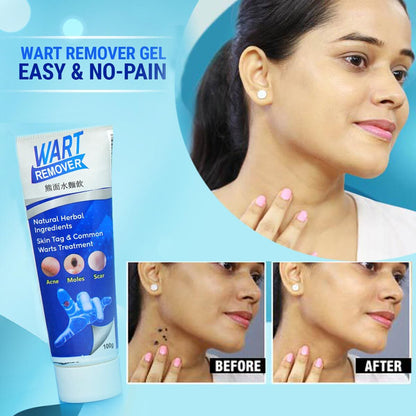 Instant Wart Remover - Buy 1 Get 1 Free