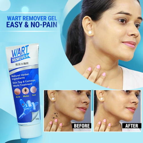 Instant Wart Remover - Buy 1 Get 1 Free